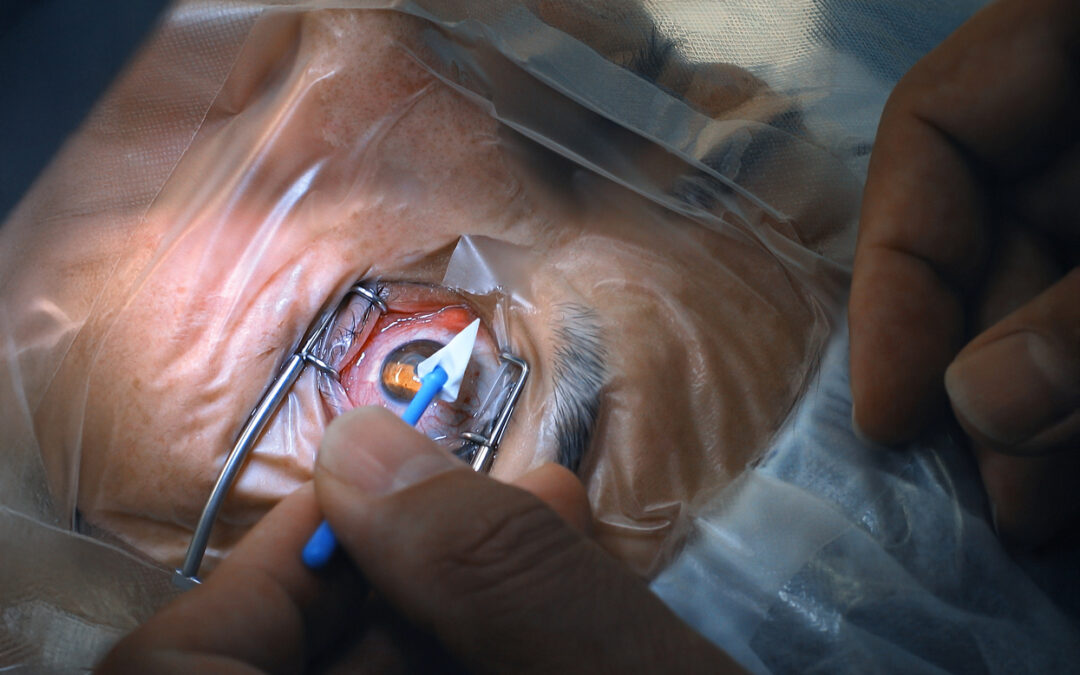 ROI of Single-Use Ophthalmic Instruments in High-Volume Surgery